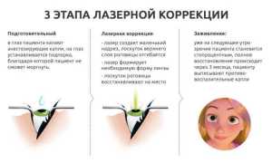 Коррекция глаз – противопоказания к лазерной операции для зрения и их влияние