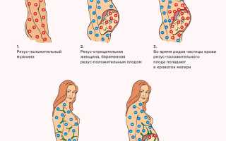 Что означает резус конфликт матери и плода: диагностика, лечение, роды и их последствия
