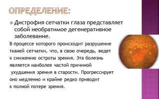 Особенности лечения дистрофии сетчатки глаза: важные аспекты и рекомендации