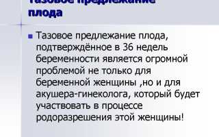 Роды при тазовом предлежании плода: особенности и рекомендации