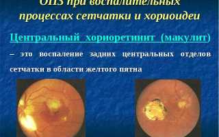 Искусственный глаз – срок службы протеза хрусталика и его особенности