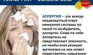 Покраснение вокруг глаза, раздражение и зуд, красные пятна на лице – что делать для облегчения симптомов