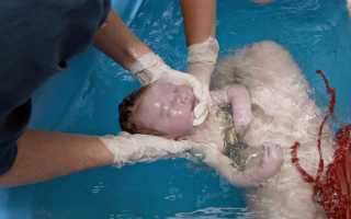 Роды в воде и в воду: плюсы и минусы для будущих мам