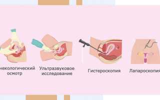 Разрыв яичника при беременности — как заподозрить и что делать в экстренной ситуации