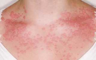 Температура после еды