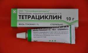 Капли для глаз Тетрациклин и как мазать и закладывать тетрациклиновую мазь правильно