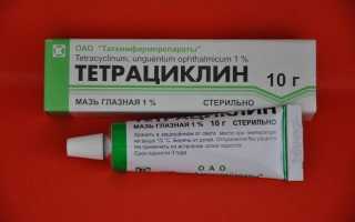 Капли для глаз Тетрациклин и как мазать и закладывать тетрациклиновую мазь правильно