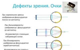 Как выбрать линзы для очков и не ошибиться? Полезные советы