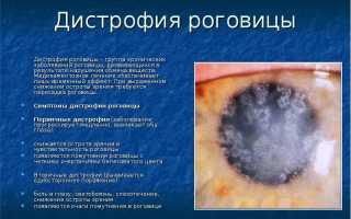 Что такое дистрофия роговицы глаза? Узнайте больше о заболевании.