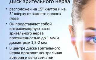 Застойный диск зрительного нерва: причины и лечение заболевания у пациентов