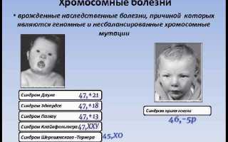 Хромосомные аномалии плода: причины и последствия