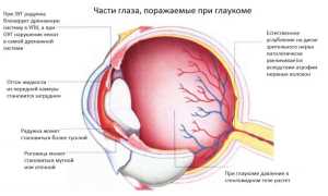 Какие глазные капли используются для лечения глаукомы и повышенного глазного давления: полезная информация