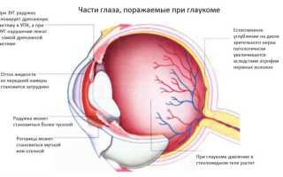 Какие глазные капли используются для лечения глаукомы и повышенного глазного давления: полезная информация