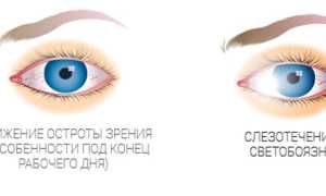 Обзор эффективных увлажняющих глазных капель для здоровья глаз