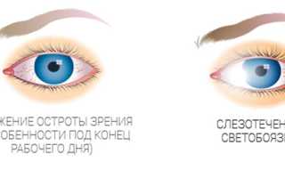 Все про компьютерный зрительный синдром и его последствия