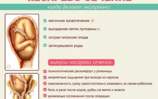 В каких случаях назначают экстренное кесарево сечение, показания и рекомендации