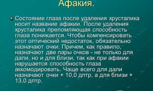 Афакия: особенности болезни и методы лечения, их влияние на зрение
