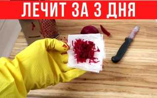 Жировик: все способы лечения липомы — медицина и народные средства, видео