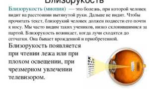 Капли для улучшения зрения при близорукости – виды и особенности применения для здоровья глаз