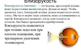 Капли для улучшения зрения при близорукости – виды и особенности применения для здоровья глаз