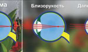Подбор контактных линз – дело специалиста и важный шаг к комфорту