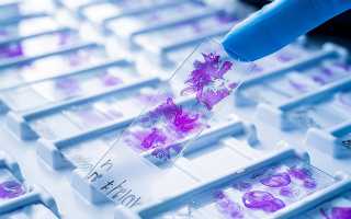 Гистологические исследования плода: что это такое и когда необходимо для диагностики