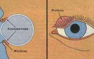 Ячмень на глазу: причины появления и методы лечения для здоровья глаз