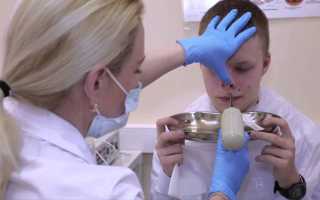 Гайморит и микрогайморотомия: лечение и операция, народные средства, видео