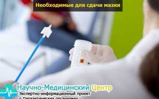 Мазок какие показатели при молочнице