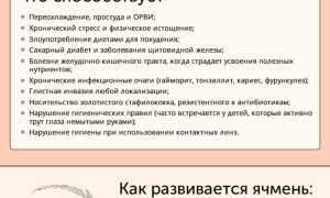 Особенности лечения ячменя на глазу у ребенка: советы и рекомендации