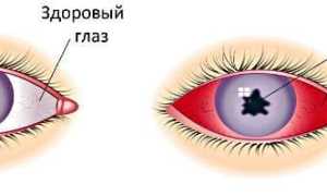 Тренировка зрения для улучшения восприятия