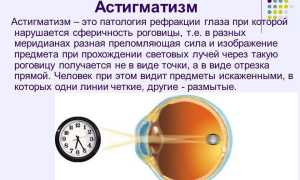 Как определить астигматизм в домашних условиях, тесты онлайн и советы специалистов