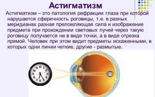 Как определить астигматизм в домашних условиях, тесты онлайн и советы специалистов