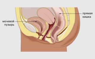 Цистит во время беременности: причины и лечение