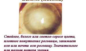 Помутнение роговицы глаза – ключевые особенности, опасности и подходы к терапии для здоровья