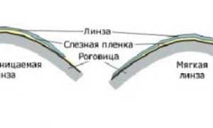 Линзы на полгода для комфортного ношения