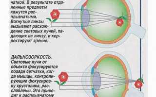 Симптомы конъюнктивита у детей и методы лечения в домашних условиях