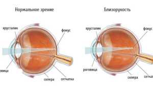 Очки для детей для зрения и здоровья глаз
