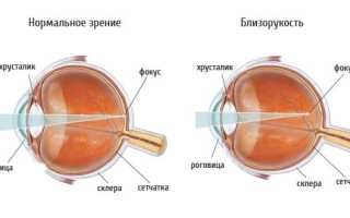 Очки для детей для зрения и здоровья глаз