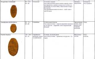 Правила забора испражнений на яйца гельминтов цисты лямблий