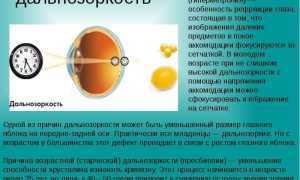 Глазные капли для улучшения зрения при дальнозоркости: полезные советы и рекомендации