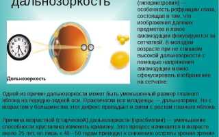 Глазные капли для улучшения зрения при дальнозоркости: полезные советы и рекомендации