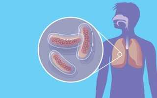 Двухсторонняя пневмония может быть после нее туберкулез