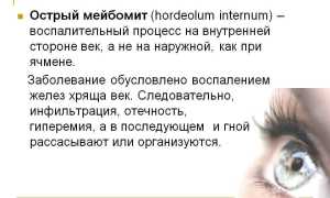 Симптомы, причины развития, осложнения и лечение мейбомита у взрослых