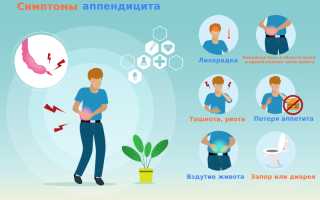 Воспаление аппендикса во время беременности: симптомы, осложнения и лечение