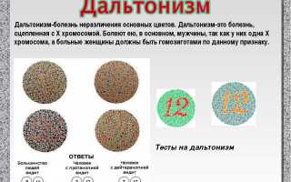 Как проводится проверка зрения на цветовосприятие у взрослых