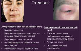 Отекают верхние веки: почему это происходит и что делать для улучшения состояния