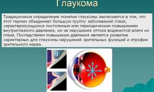Вторичная глаукома: почему она появляется и как лечить правильно