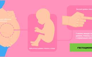 Как протекает беременность при сахарном диабете: важные аспекты и рекомендации