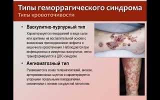 Геморрагический диатез: как проявляется и чем лечить-видео, кровотечения и отеки